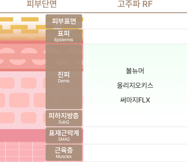 고주파 RF의 종류에는 볼뉴머,올리지오키스,써마지FLX가 있으며 피부단면의 피부표면,표피(Epidermis),진피(Demis),피하지방층(SubQ),표재근막계(SMAS),근육층(Muscles) 중에서 진피(Demis),피하지방층(SubQ)에 도달합니다.